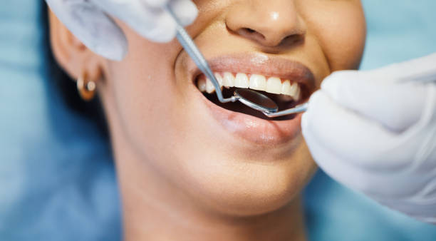 Best Emergency Cosmetic Dentistry in Union City, IN